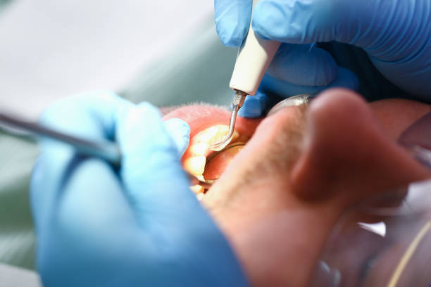 Best Urgent Dental Care for Toothache in Vienna, IL
