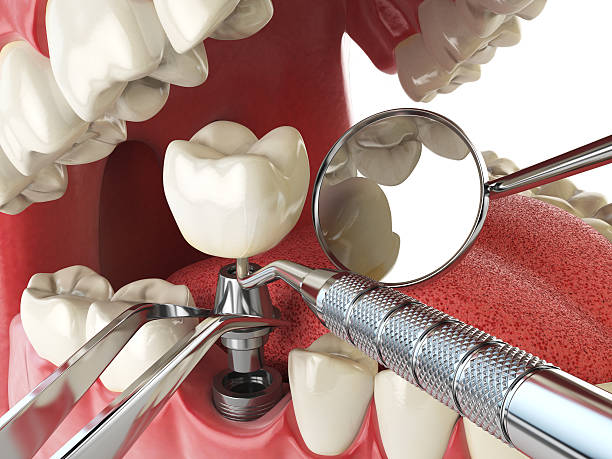 Best Weekend Emergency Dentist in Vienna, IL